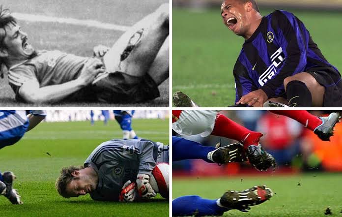 Top the weirdest injuries in football history